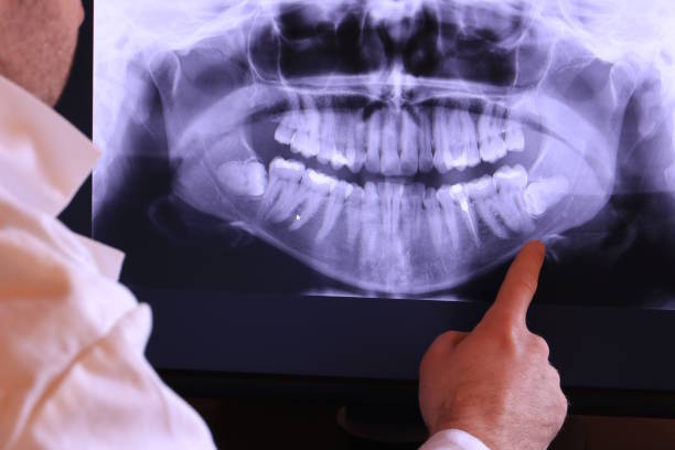 Best Emergency Treatment for Dental Infections or Abscesses in Industry, PA